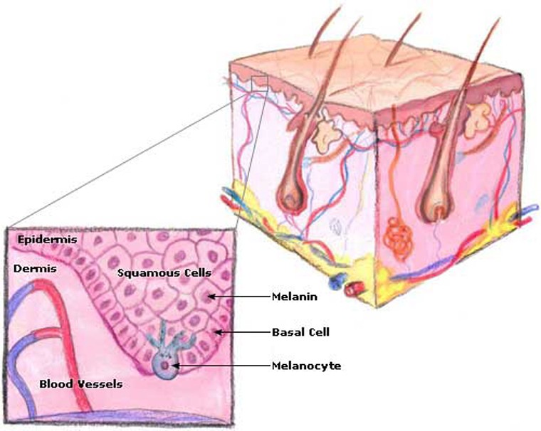 Một khi làn da không tự tiết ra đủ sắc tố melanin để tự bảo vệ thì các tia cực tím có trong ánh mặt trời sẽ tấn công, tiêu diệt tế bào da, gây cháy nắng kèm những vết thương nhỏ. Sức tàn phá của nó giống như khi bạn dùng một thanh sắt nóng đặt lên da vậy.